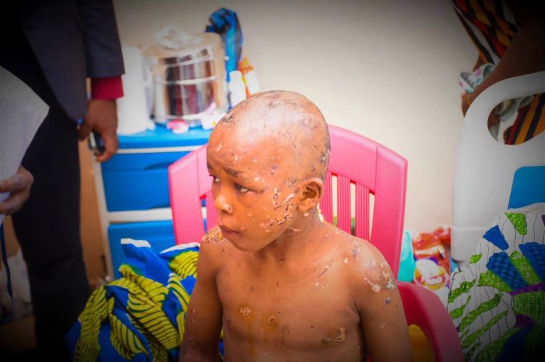 ANAMBRA ASSEMBLY DEMANDS JUSTICE FOR ALLEGEDLY TORTURED 10-YEAR-OLD, ORDERS REVIEW OF CHILD PROTECTION LAWS