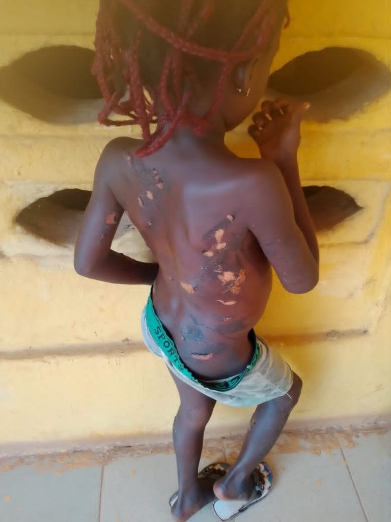POLICE ARREST 32-YEAR-OLD WOMAN FOR ALLEGEDLY ABUSING SEVEN-YEAR-OLD DAUGHTER IN ANAMBRA